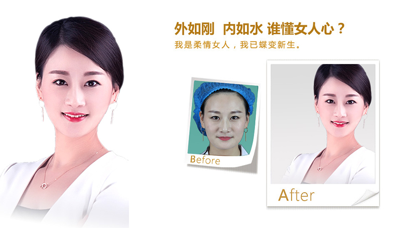 高雄V脸、线雕隆鼻